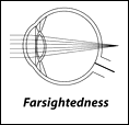 farsightedness.gif (2016 bytes)